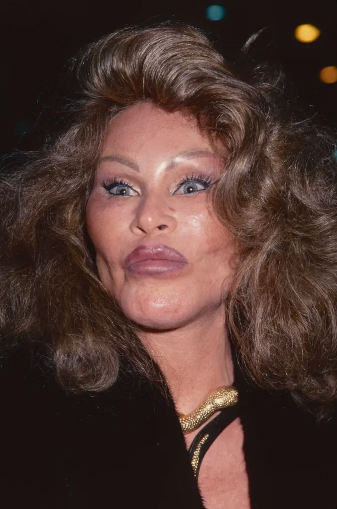 Jocelyn Wildenstein 1 1015x1536 1