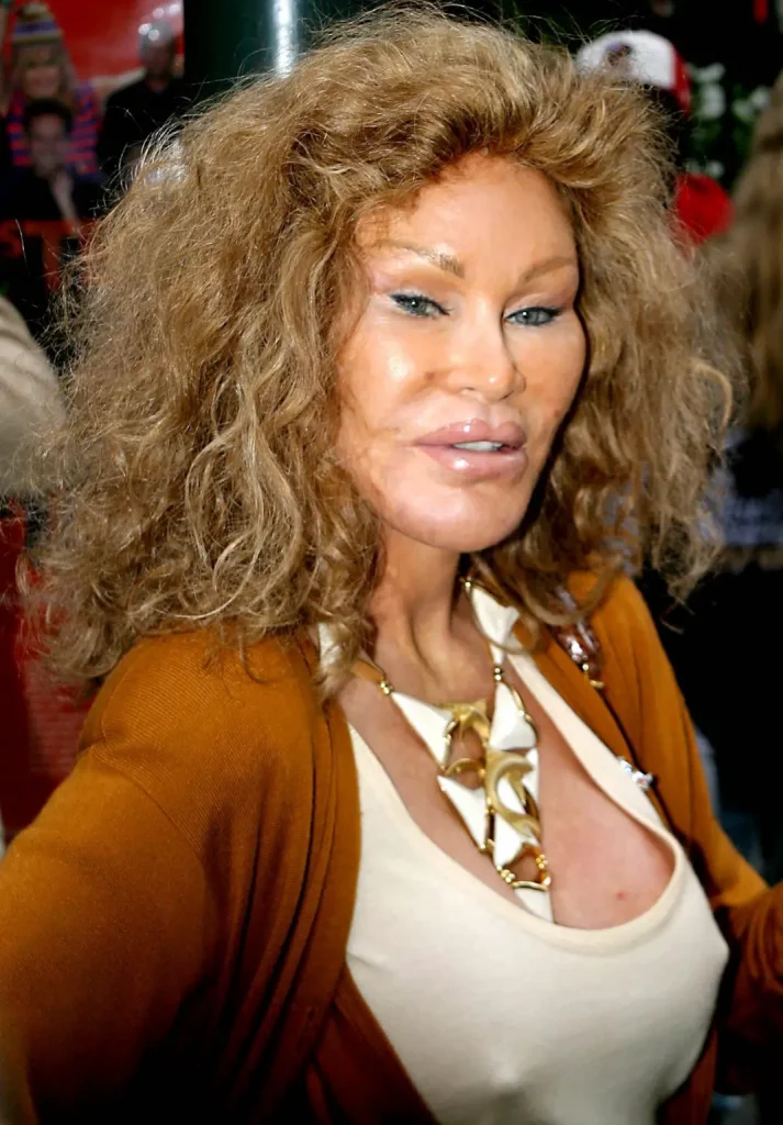 Jocelyn Wildenstein 3 1069x1536 1